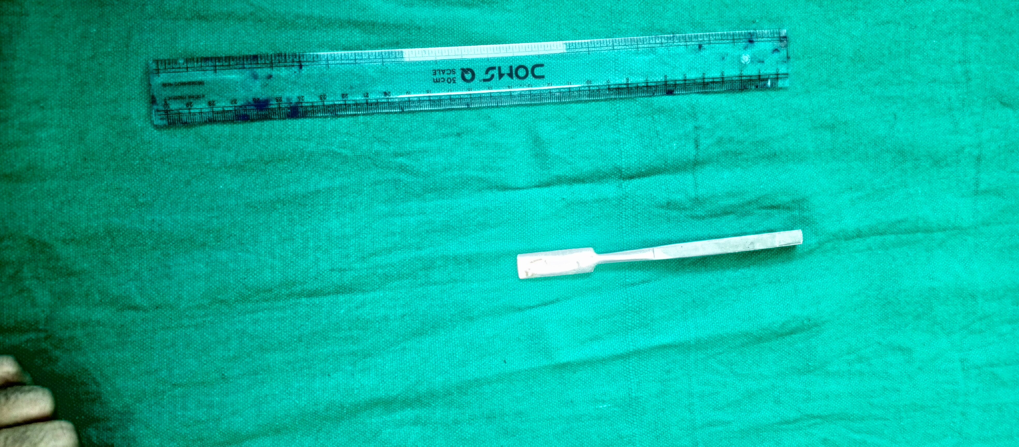Nasal Bone File